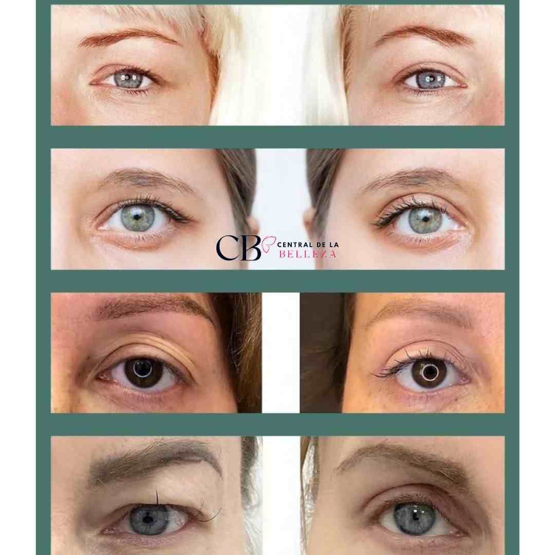 VivaMirada: Cintas Lifting para Párpados, Mirada Más Juvenil y Radiante - 240uds