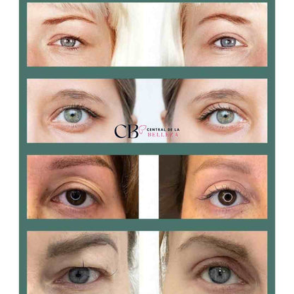 VivaMirada: Cintas Lifting para Párpados, Mirada Más Juvenil y Radiante - 240uds